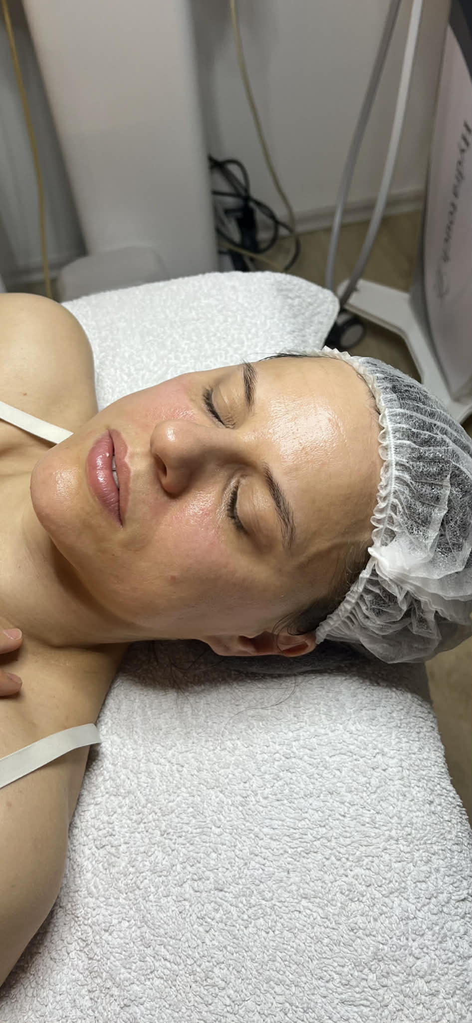 Elektroporációs Kezelés Után