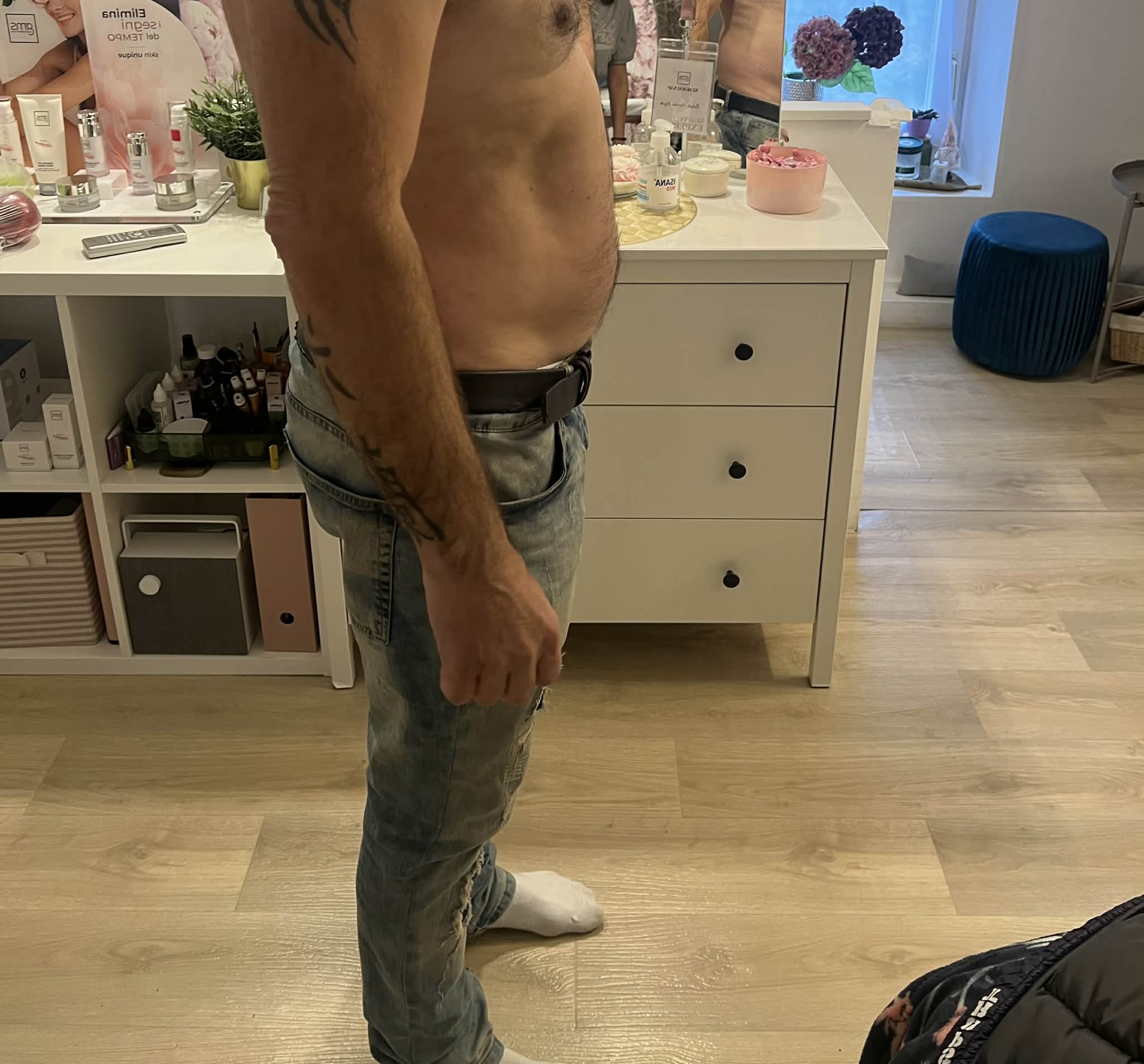 Lipolézer Kezelés Után