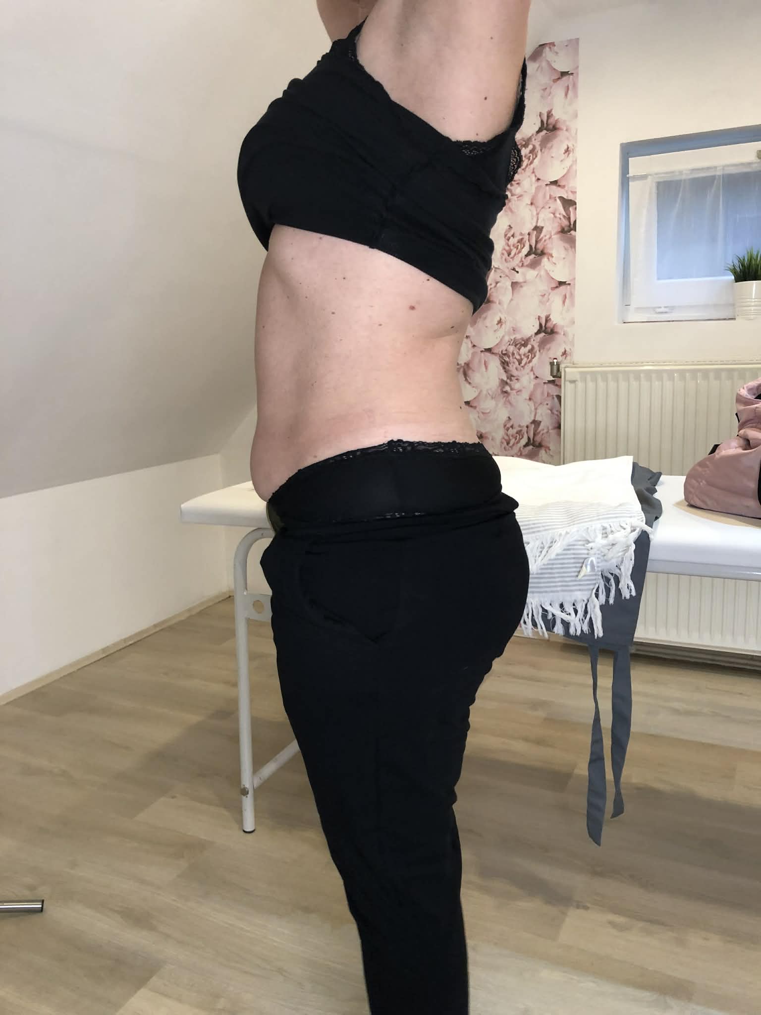 Wiener Kezelés Előtt